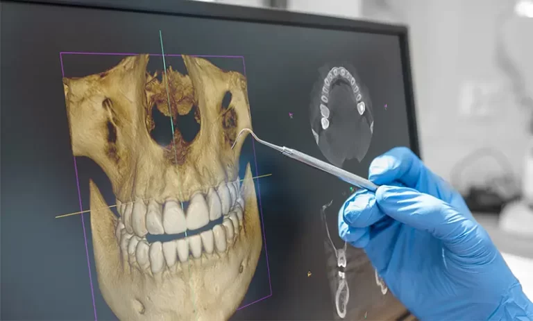 اسکن سه بعدی دندان برای ایمپلنت