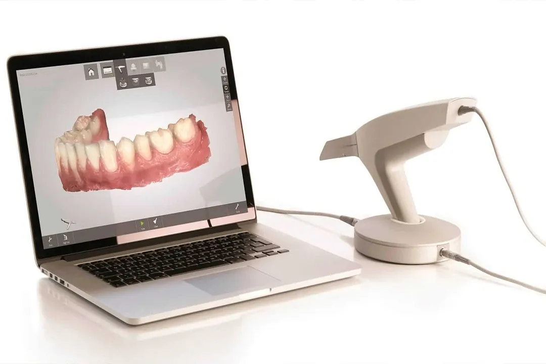 اسکنرهای دیجیتال با ارائه تصاویر دقیق و باکیفیت از ساختار دهان و دندان، به دندانپزشکان کمک میکنند تا برنامهریزی درمانی دقیقتری انجام دهند.