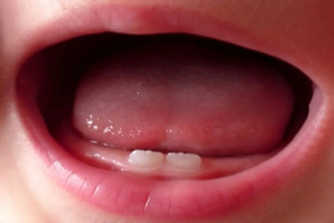 دندانهای شیری (Deciduous teeth) اولین دسته از دندانها هستند که در دهان کودک ظاهر میشوند.