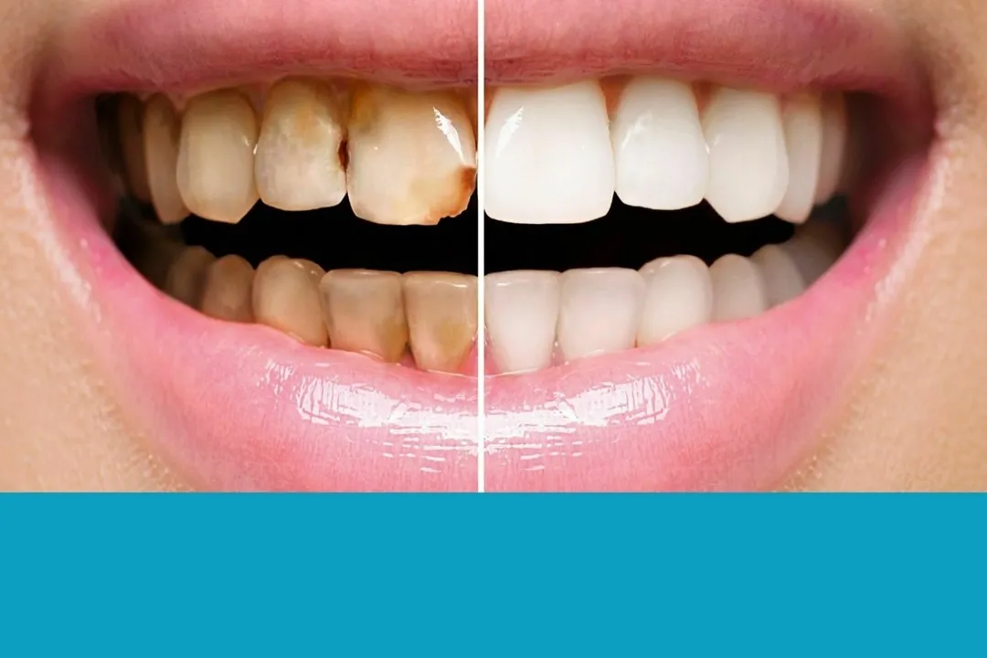 دندانپزشکی ترمیمی یکی از حوزههای پیشرو در پزشکی است که به سرعت با نوآوریها و پیشرفتهای علمی و تکنولوژیکی تغییر میکند.