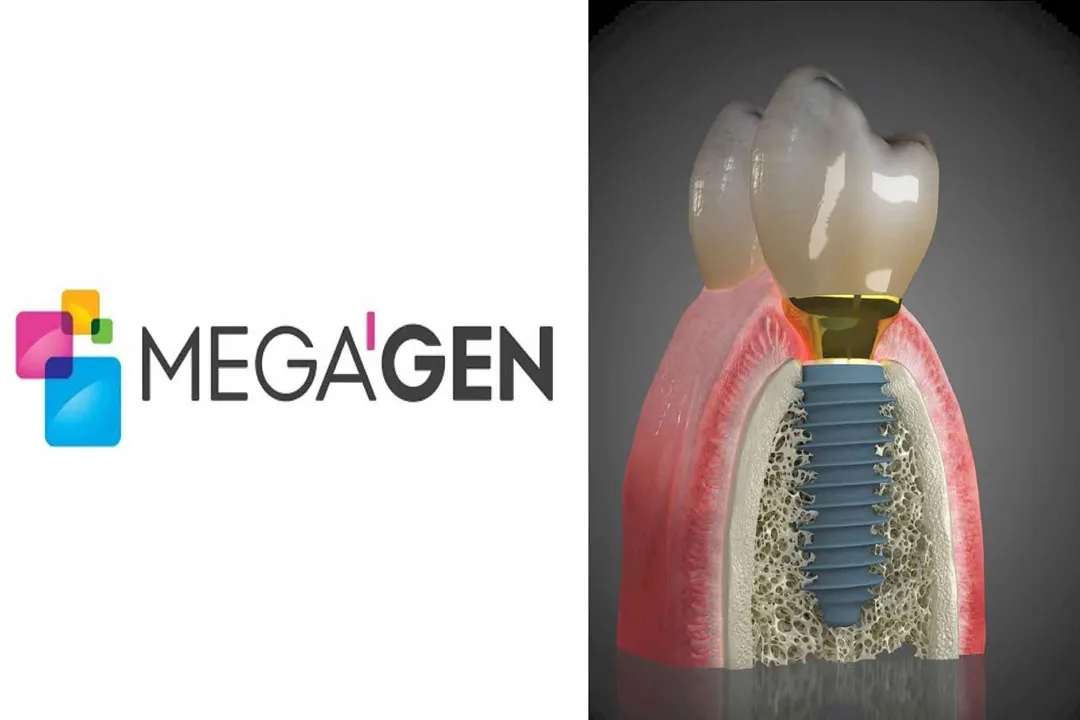 مگاژن (Megagen) – کره جنوبی تکنولوژیهای نوآورانه برای بهبود روند درمان