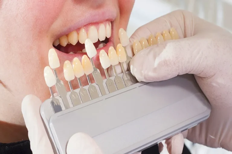 راهنمای مراقبت و نگهداری از دستگاه کالرشید