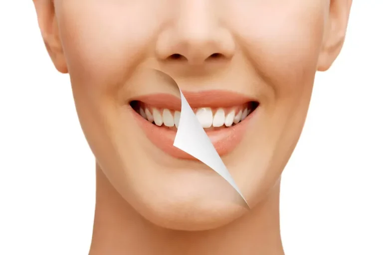 اهمیت یکسان بودن رنگ دندان برای بیمار