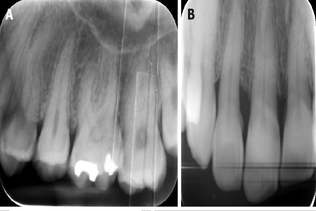 فسفر پلیت‌ها تصاویری با رزولوشن بالا تولید می‌کنند