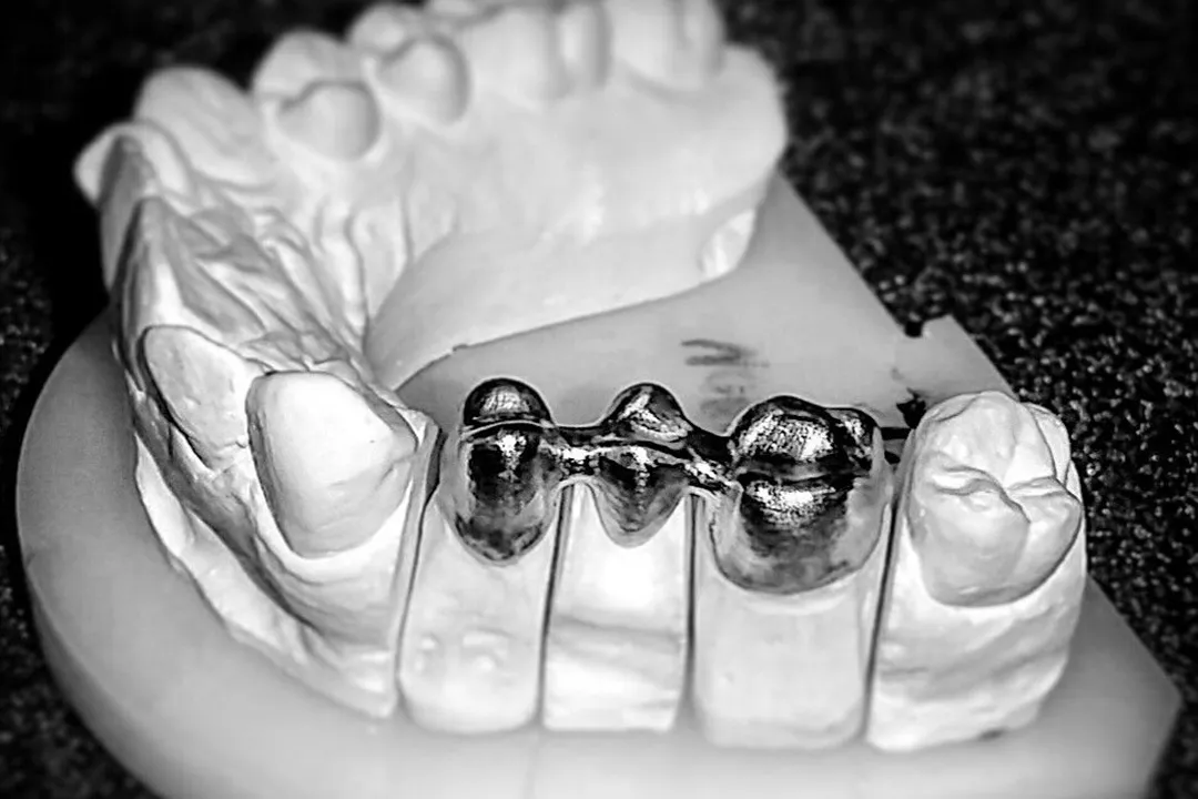 پرینتر سهبعدی از مواد متنوعی مانند پلیاترکتون و فلزات مانند تیتانیوم و کبالتکروم استفاده میکند