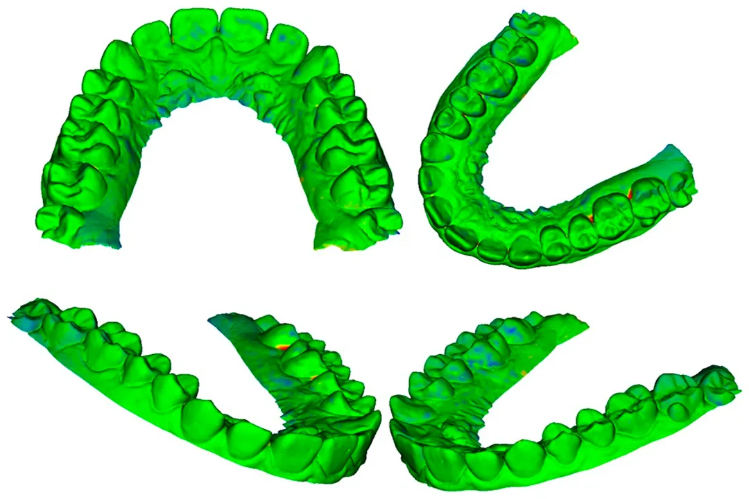 فوتوگرامتری برای ایجاد مدل‌های سه‌بعدی از دندان‌ و فک‌ برای ارتودنسی استفاده می‌شود.