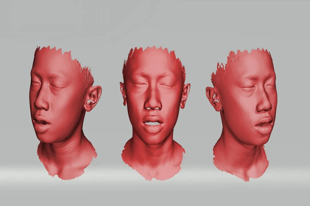 دقت یک معیار مهم در ارزیابی یک اسکنر داخل دهانی است.