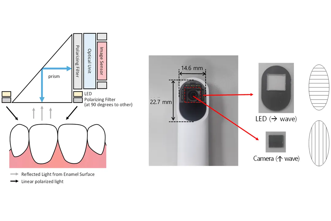 دستگاه کالرشید برای شناسایی و تحلیل دقیق رنگ‌ و سایه‌ در دندانپزشکی به کار می‌رود.