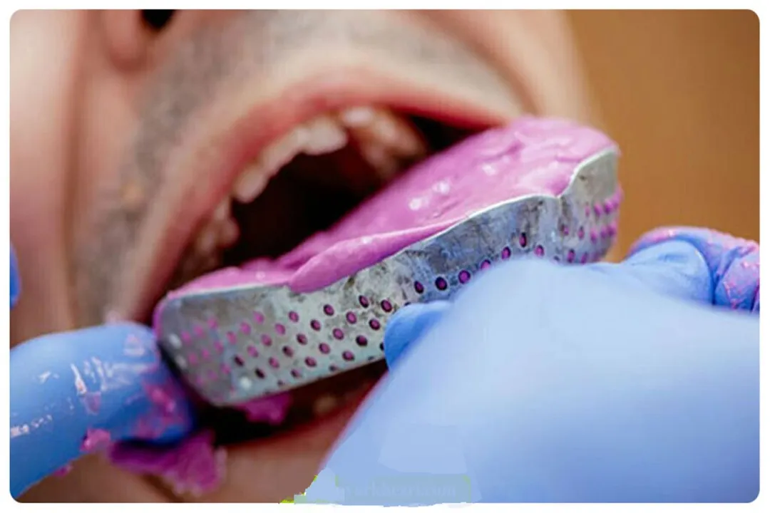 روش‌ سنتی مانند قالب‌گیری با خمیر شیمیایی زمان‌بر است