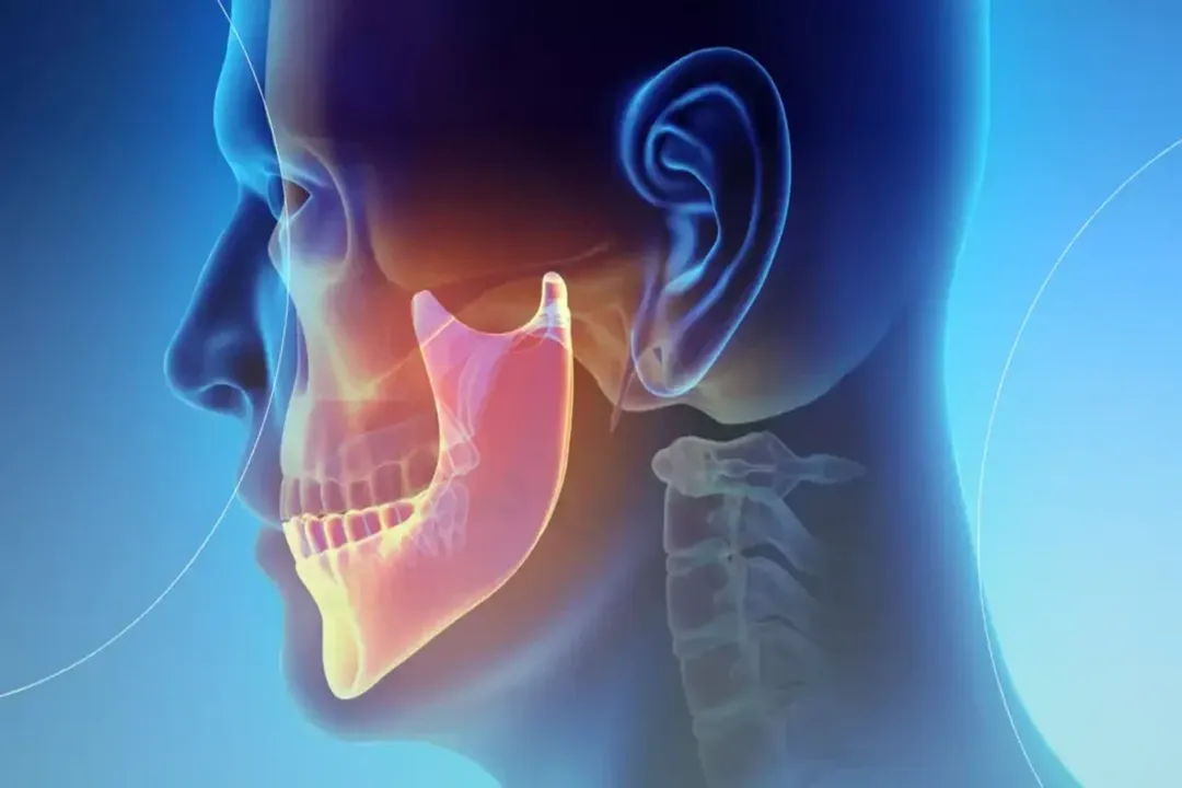 فک انسان یکی از مهمترین ساختارهای صورت است که نقش مهمی در زیباییشناسی دارد.